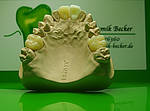 Dental Keramik Becker Leistungsspektrum e.max Kronen